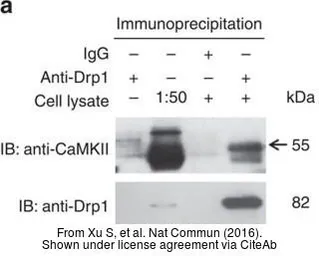 Anti-CaMKII delta antibody used in Western Blot (WB). GTX111401