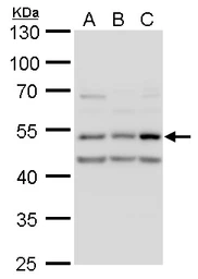Anti-CaMKII delta antibody used in Western Blot (WB). GTX111401