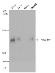 Anti-PRKCBP1 antibody used in Western Blot (WB). GTX111462
