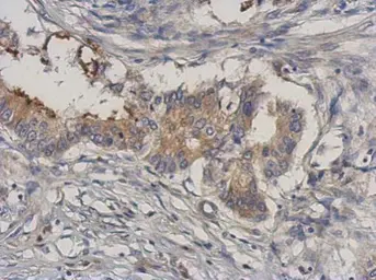 Anti-MEKK3 antibody [N3C2], Internal used in IHC (Paraffin sections) (IHC-P). GTX111498