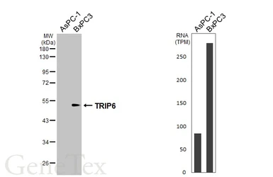 Anti-TRIP6 antibody [N3C3] used in Western Blot (WB). GTX111504