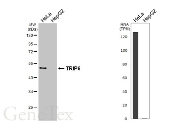 Anti-TRIP6 antibody [N3C3] used in Western Blot (WB). GTX111504