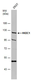 Anti-HKDC1 antibody used in Western Blot (WB). GTX111506