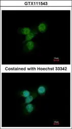 Anti-LYN antibody [N2C3] used in Immunocytochemistry/ Immunofluorescence (ICC/IF). GTX111543