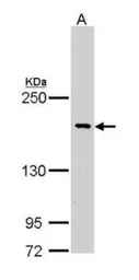 Anti-Bcr antibody [C2C3-2], C-term used in Western Blot (WB). GTX111591
