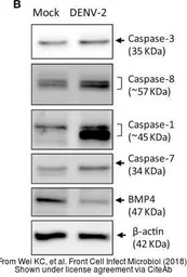 Anti-Caspase 1 antibody used in Western Blot (WB). GTX111630