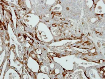 Anti-Collagen III antibody [C2C3-2], C-term used in IHC (Paraffin sections) (IHC-P). GTX111643
