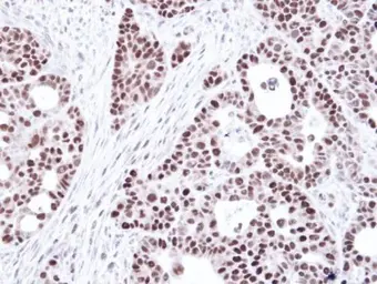 Anti-MSH6 antibody [C1C2], Internal used in IHC (Paraffin sections) (IHC-P). GTX111661