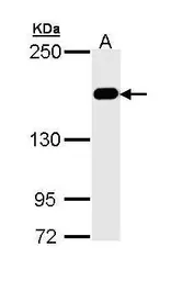 Anti-MSH6 antibody [C1C2], Internal used in Western Blot (WB). GTX111661