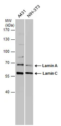 Anti-Lamin A + C antibody used in Western Blot (WB). GTX111677