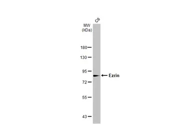 Anti-Ezrin antibody [N2C2], Internal used in Western Blot (WB). GTX111709
