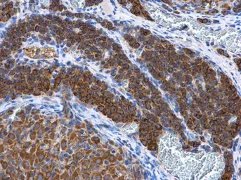Anti-Adenylate kinase 2 antibody [N1C3-2] used in IHC (Paraffin sections) (IHC-P). GTX111737