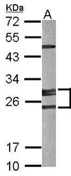 Anti-Adenylate kinase 2 antibody [N1C3-2] used in Western Blot (WB). GTX111737