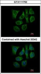 Anti-GALK2 antibody used in Immunocytochemistry/ Immunofluorescence (ICC/IF). GTX111750