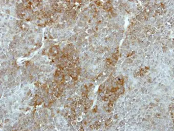 Anti-GALK2 antibody used in IHC (Paraffin sections) (IHC-P). GTX111750