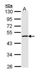 Anti-GALK2 antibody used in Western Blot (WB). GTX111750