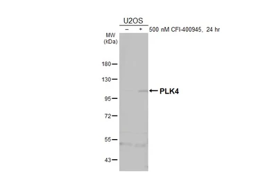 Anti-PLK4 antibody used in Western Blot (WB). GTX111754