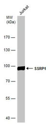 Anti-SSRP1 antibody [N1N3] used in Western Blot (WB). GTX111816