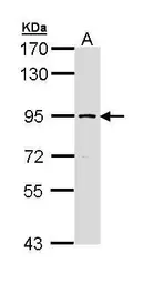 Anti-SSRP1 antibody [N1N3] used in Western Blot (WB). GTX111816
