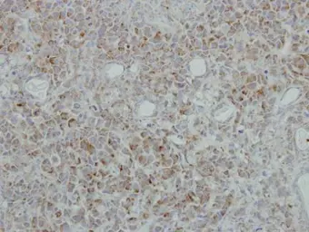 Anti-NDUFB5 antibody used in IHC (Paraffin sections) (IHC-P). GTX111880
