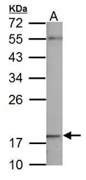 Anti-NDUFB5 antibody used in Western Blot (WB). GTX111880