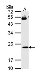 Anti-RAP1B antibody used in Western Blot (WB). GTX111933