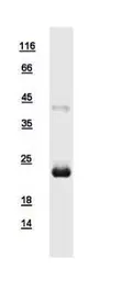 Human TNFAIP8 protein, His tag. GTX111940-pro