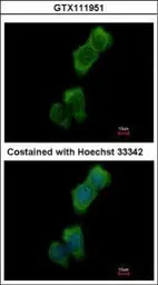 Anti-LOK antibody [N1N2], N-term used in Immunocytochemistry/ Immunofluorescence (ICC/IF). GTX111951
