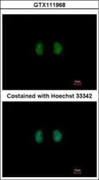 Anti-IPPK antibody [N2C2], Internal used in Immunocytochemistry/ Immunofluorescence (ICC/IF). GTX111968