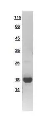 Human GMF Beta protein, His tag. GTX111991-pro