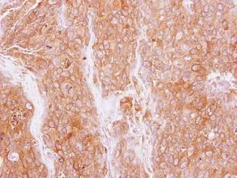 Anti-GMF beta antibody [N1C3] used in IHC (Paraffin sections) (IHC-P). GTX111991