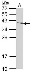 Anti-SAP30BP antibody used in Western Blot (WB). GTX112067