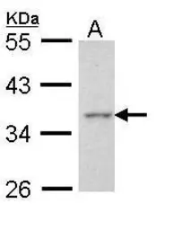 Anti-Apoptosis-enhancing nuclease antibody [C2C3], C-term used in Western Blot (WB). GTX112086