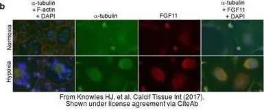 Anti-alpha Tubulin antibody used in Immunocytochemistry/ Immunofluorescence (ICC/IF). GTX112141