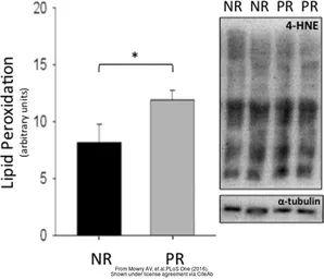 Anti-alpha Tubulin antibody used in Western Blot (WB). GTX112141