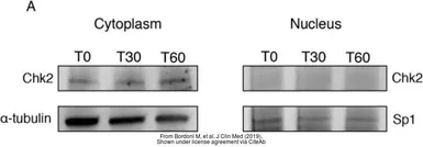 Anti-alpha Tubulin antibody used in Western Blot (WB). GTX112141
