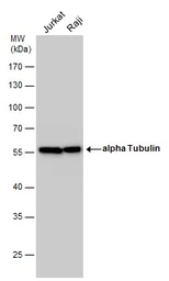 Anti-alpha Tubulin antibody used in Western Blot (WB). GTX112141
