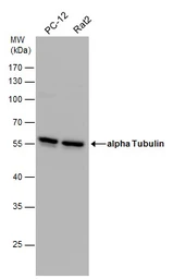 Anti-alpha Tubulin antibody used in Western Blot (WB). GTX112141