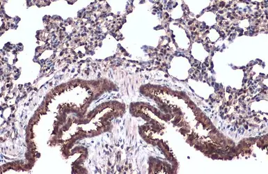 Anti-alpha Tubulin antibody used in IHC (Paraffin sections) (IHC-P). GTX112141