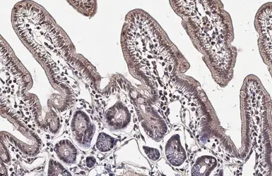 Anti-TIP60 antibody used in IHC (Paraffin sections) (IHC-P). GTX112198
