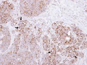 Anti-CTNNAL1 antibody [N3C2], Internal used in IHC (Paraffin sections) (IHC-P). GTX112226