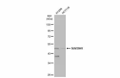Anti-SUV39H1 antibody [N3C3] used in Western Blot (WB). GTX112263