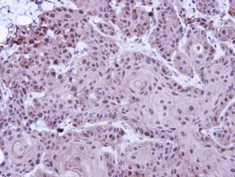 Anti-SUV39H1 antibody [N3C3] used in IHC (Paraffin sections) (IHC-P). GTX112263