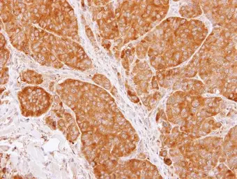 Anti-TCP1 beta antibody [C1C3] used in IHC (Paraffin sections) (IHC-P). GTX112283