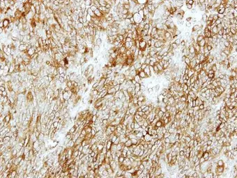 Anti-GMDS antibody [N2C3] used in IHC (Paraffin sections) (IHC-P). GTX112327
