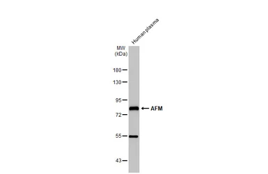 Anti-AFM antibody used in Western Blot (WB). GTX112390