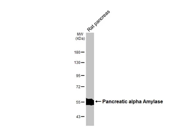 Anti-Pancreatic alpha Amylase antibody [N3C3] used in Western Blot (WB). GTX112396