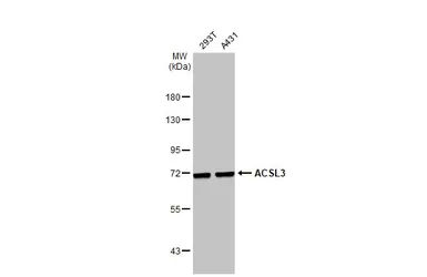 Anti-ACSL3 antibody used in Western Blot (WB). GTX112431