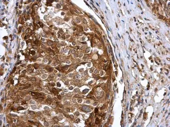 Anti-IFIT3 antibody used in IHC (Paraffin sections) (IHC-P). GTX112442