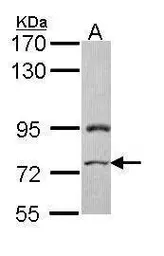 Anti-PRICKLE3 antibody [N1N3] used in Western Blot (WB). GTX112458